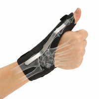 thumb spica splint